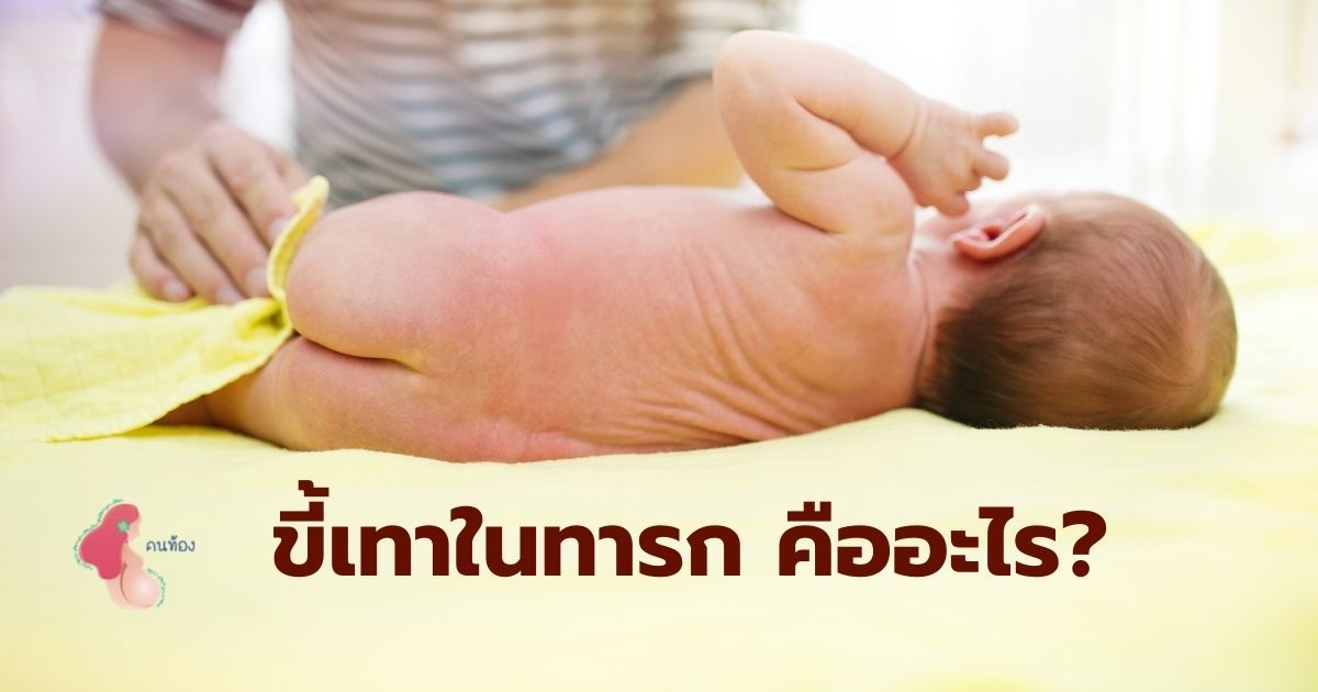 ขี้เทาในทารก คืออะไร ? บอกถึงความผิดปกติหรือไม่ เรามีคำตอบ